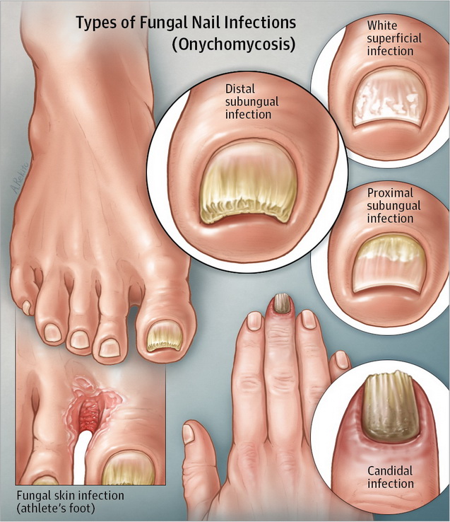 Da Vinci Clinic Skin Allergies Fungal Skin Nail Infections Treatment