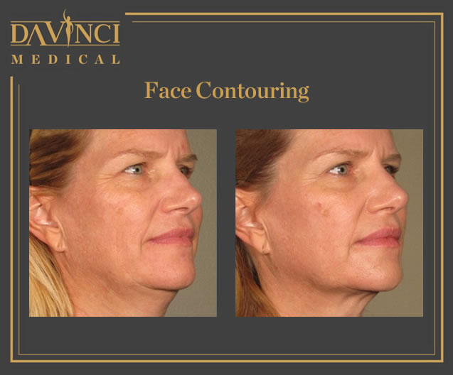 Face Contouring