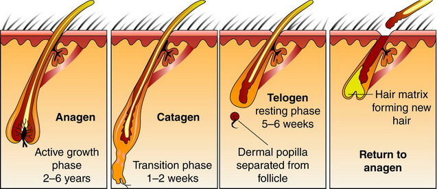 Hair Restoration