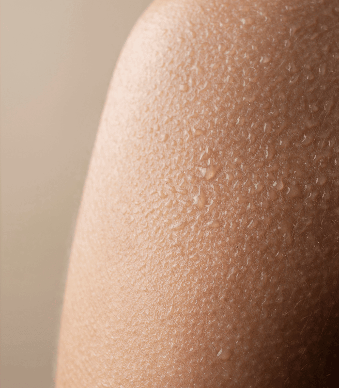 What Causes Excessive Sweating