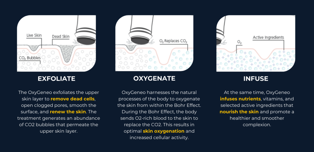 OxyGeneo Facial in KL
