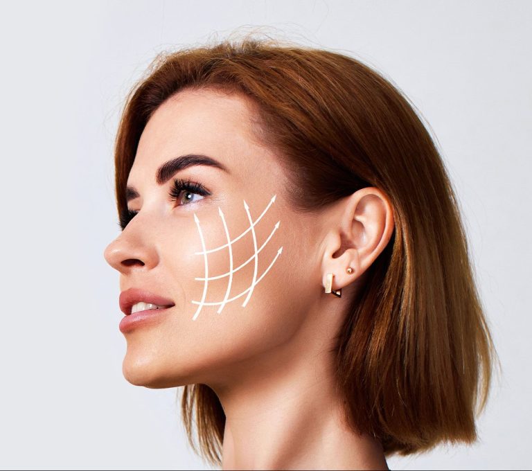 Facelift treatment at Da Vinci Clinic using advanced technologies like HIFU, Ultherapy Prime, Oligio, BTL Exion, and Fotona SP for skin tightening and lifting.