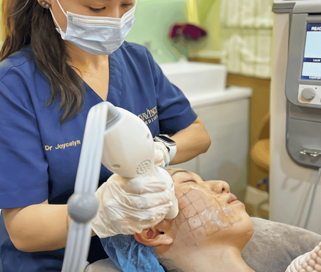 Non-surgical facelift treatment at Da Vinci Clinic using HIFU, Ultherapy Prime, Oligio, BTL Exion, and Fotona SP for skin tightening and rejuvenation.