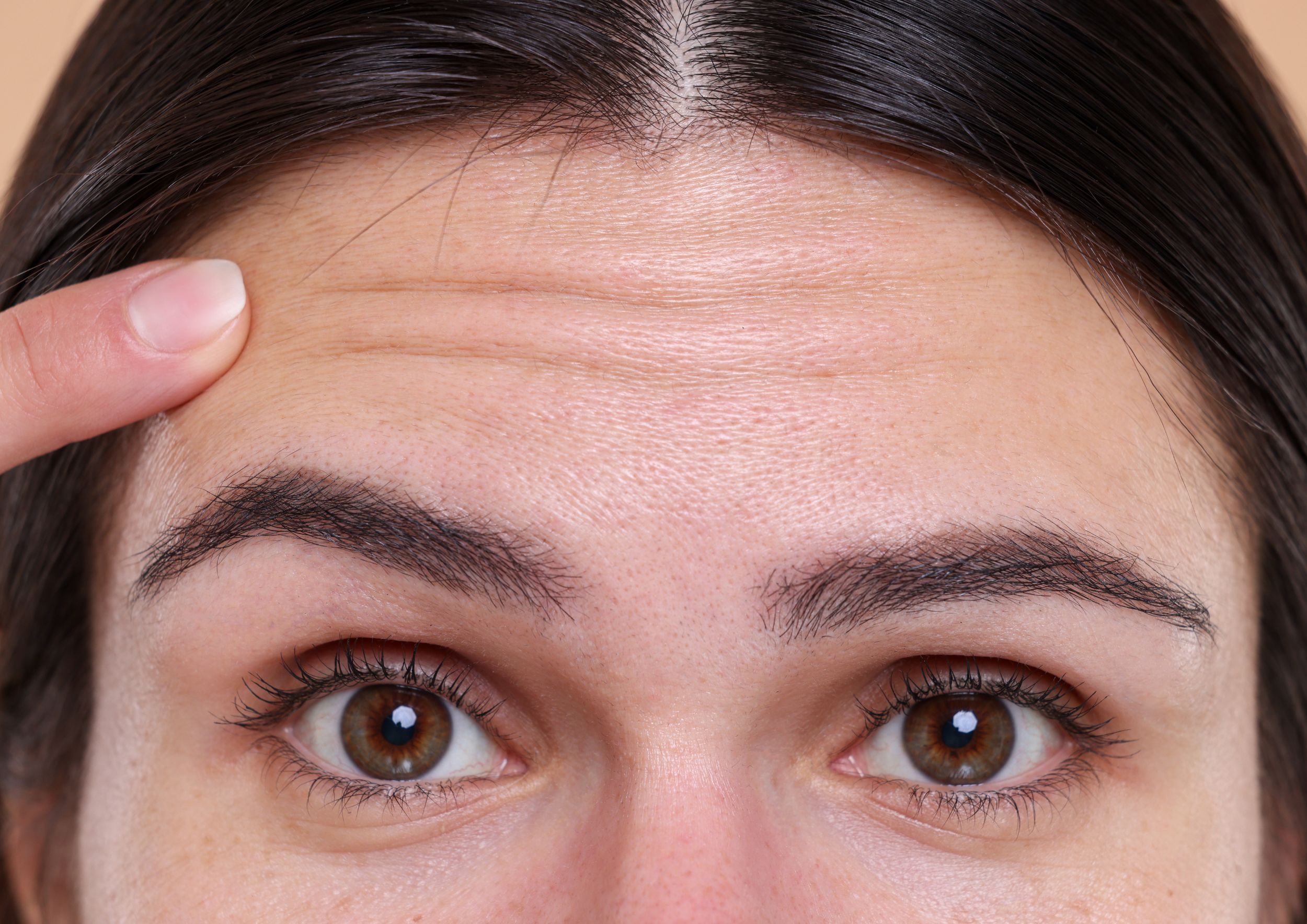 What is Botox? - Da Vinci Clinic