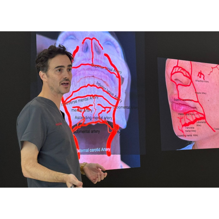 Dr Luciano explaining the anatomy and impact of Neauvia Dermal Fillers