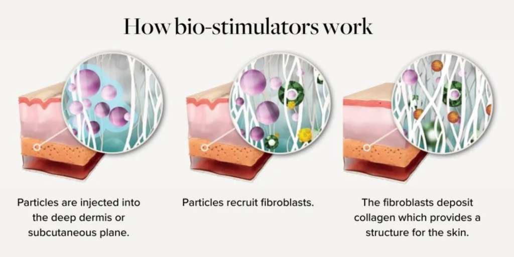 How Biostimulators work