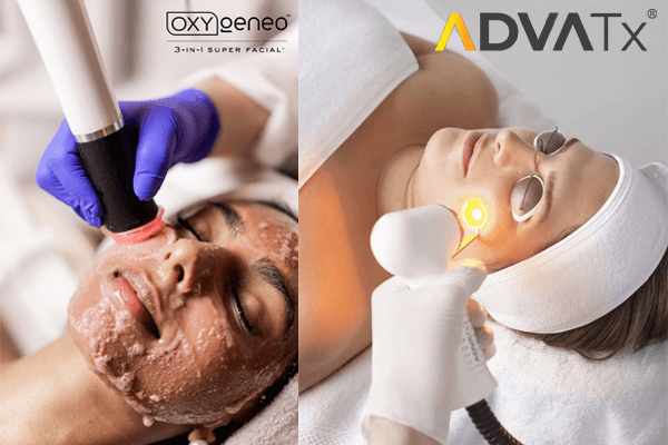 Acne Treatment Visual