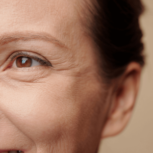 Watch fine lines fade as powerful picosecond pulses ignite collagen renewal, restoring that youthful bounce.