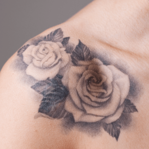 Erase old inks gently—Pico Laser fragments pigments so your body naturally clears them away for a clean canvas.