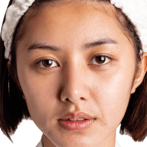 Balance your beauty—targeted energy corrects tone irregularities, unveiling a harmonized, glowing complexion.