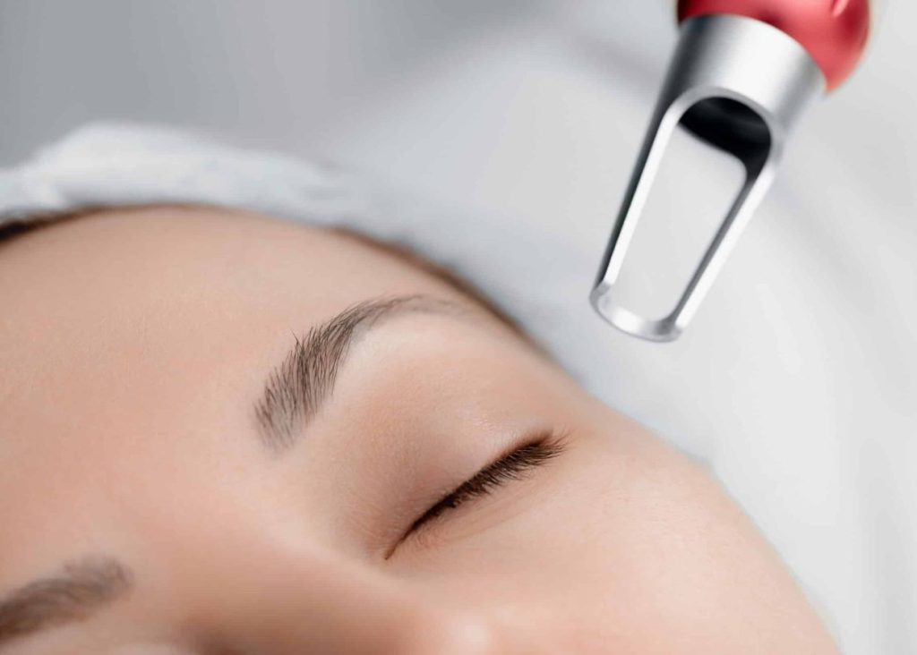 Pico Laser Treatment in KL