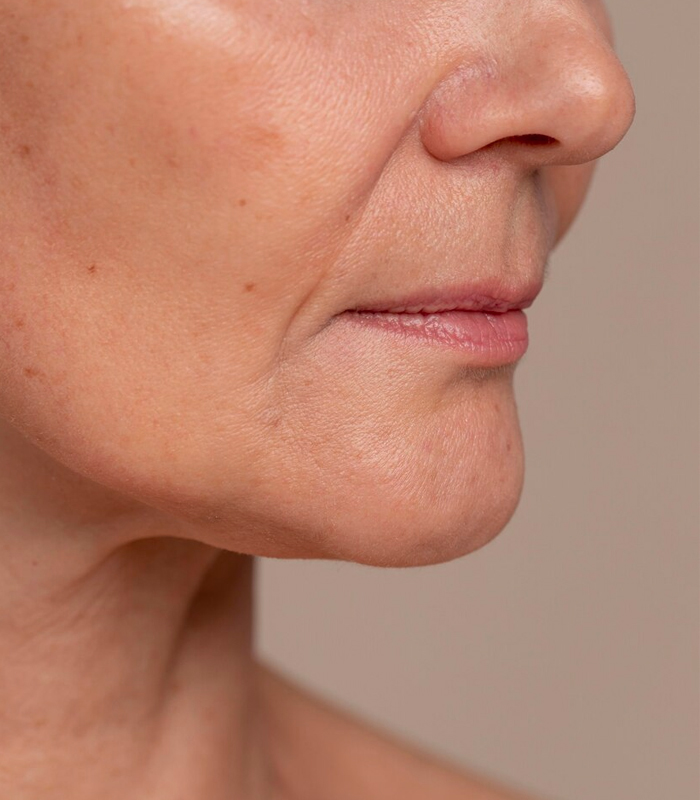 Lower Face Aesthetic Treatment at Da Vinci Clinic KL