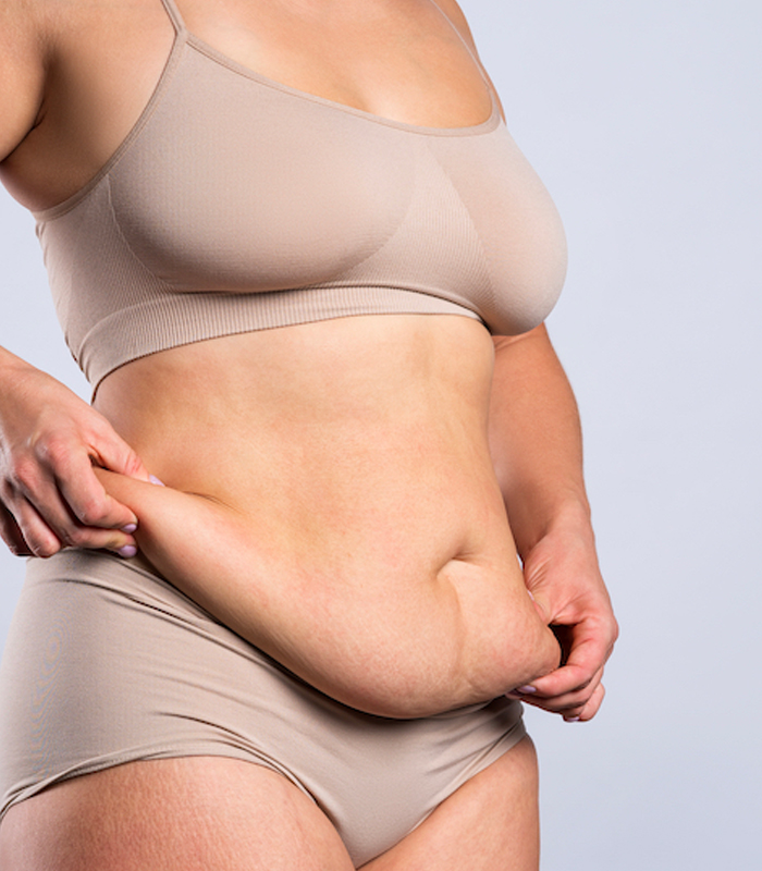 Best Cellulite Treatment in KL