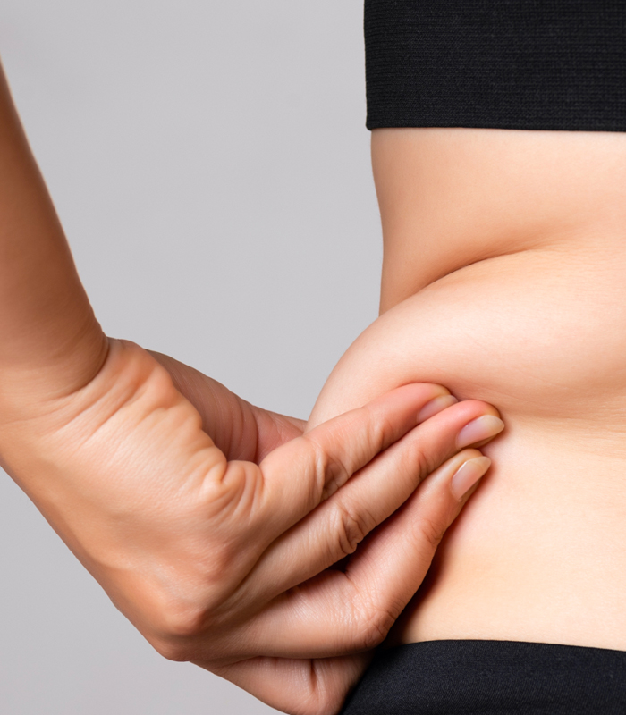 What Causes Stubborn Fat