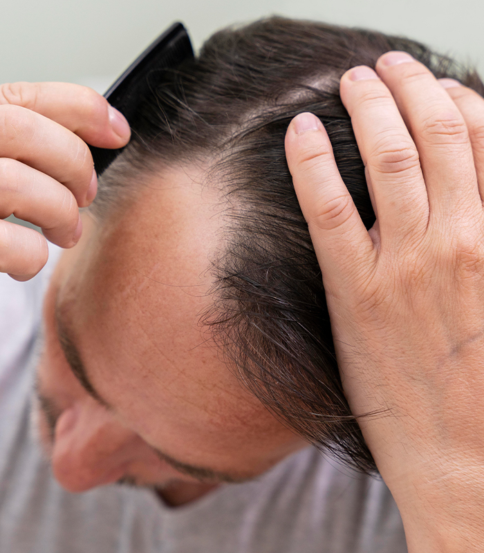 Hair Transplant Is It Safe