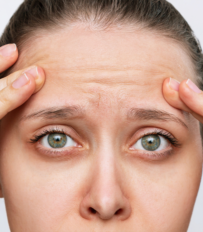 Fine Lines Treatments