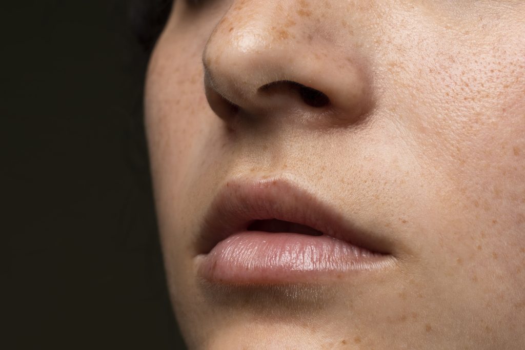 Skin Problems AdvaTX Yellow Laser Solutions