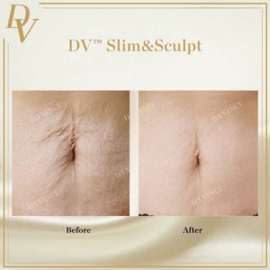 DV Slim & Sculpt
