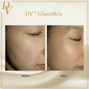 DV™ GlassSkin