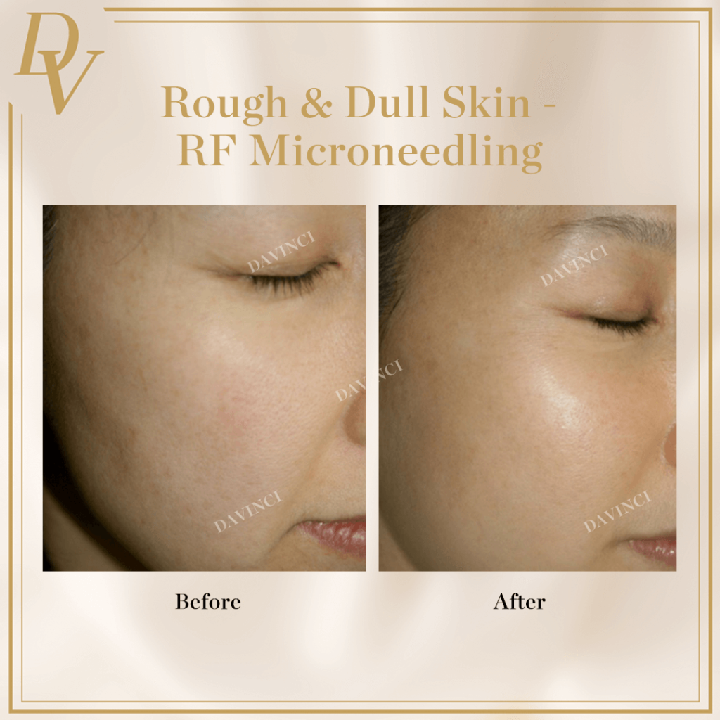 skin brightening malaysia