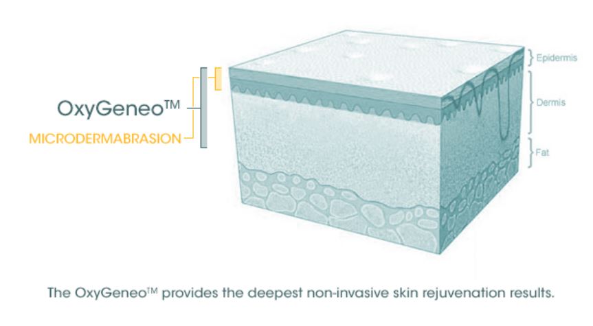 OxyGeneo Facial in KL