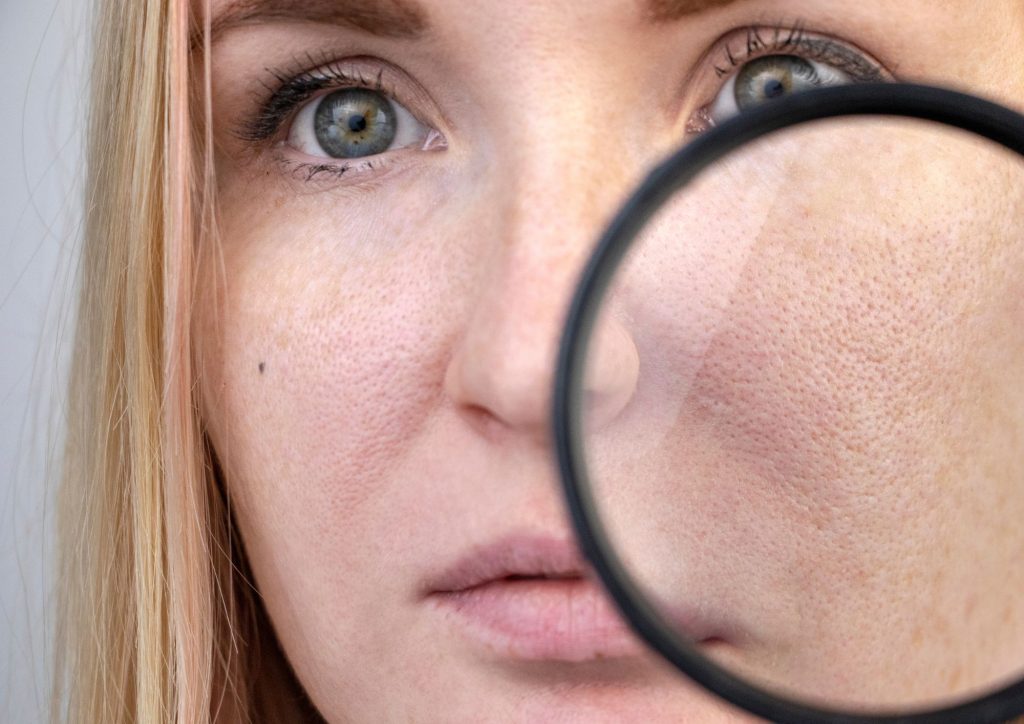 skin open pores