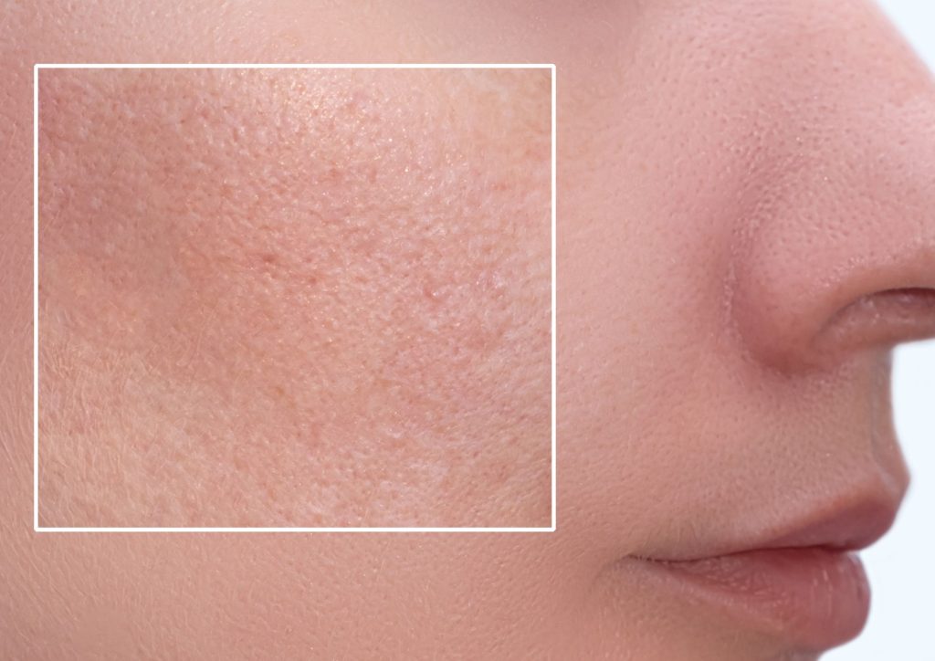skin open pores