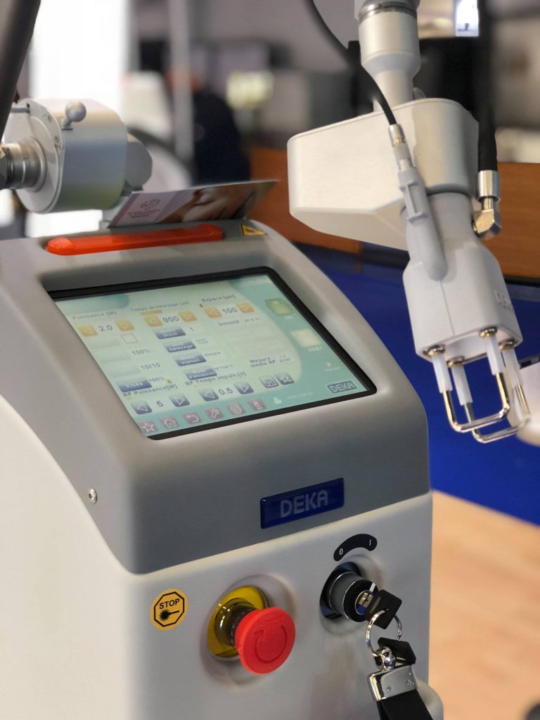 Fractional CO2 laser Treatment in KL
