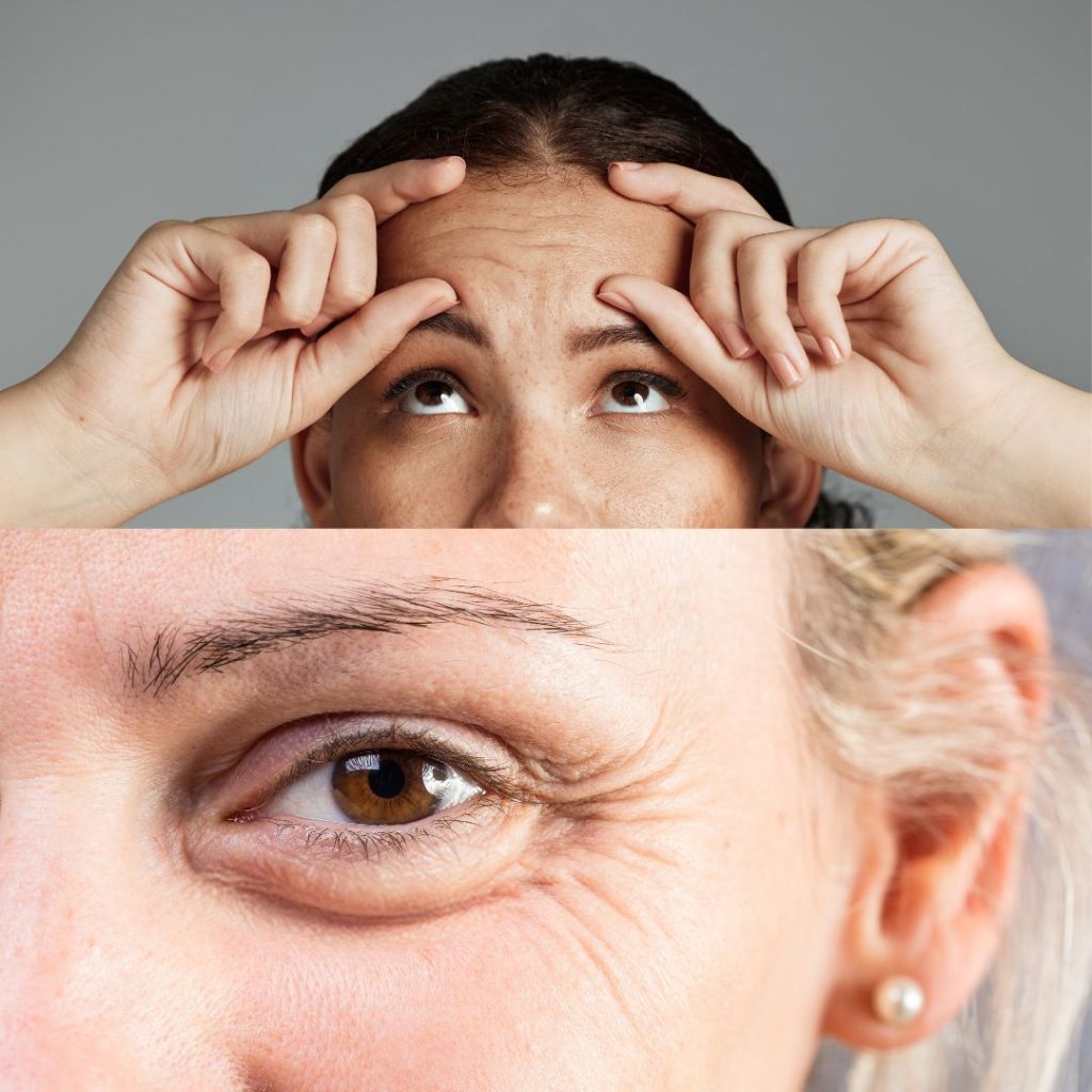 Wrinkle Treatment, Botox, Nabota, Xeomin