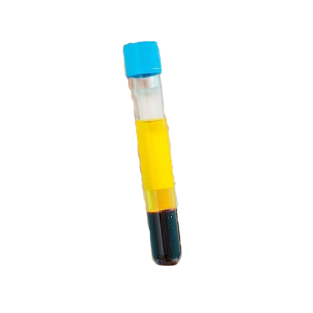 Growth Factor Hair Regeneration Treatment | Da Vinci Clinic Kuala Lumpur - Platelet Rich Plasma PRP