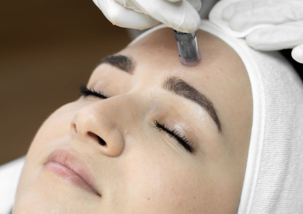 Microneedling in Da Vinci Clinic