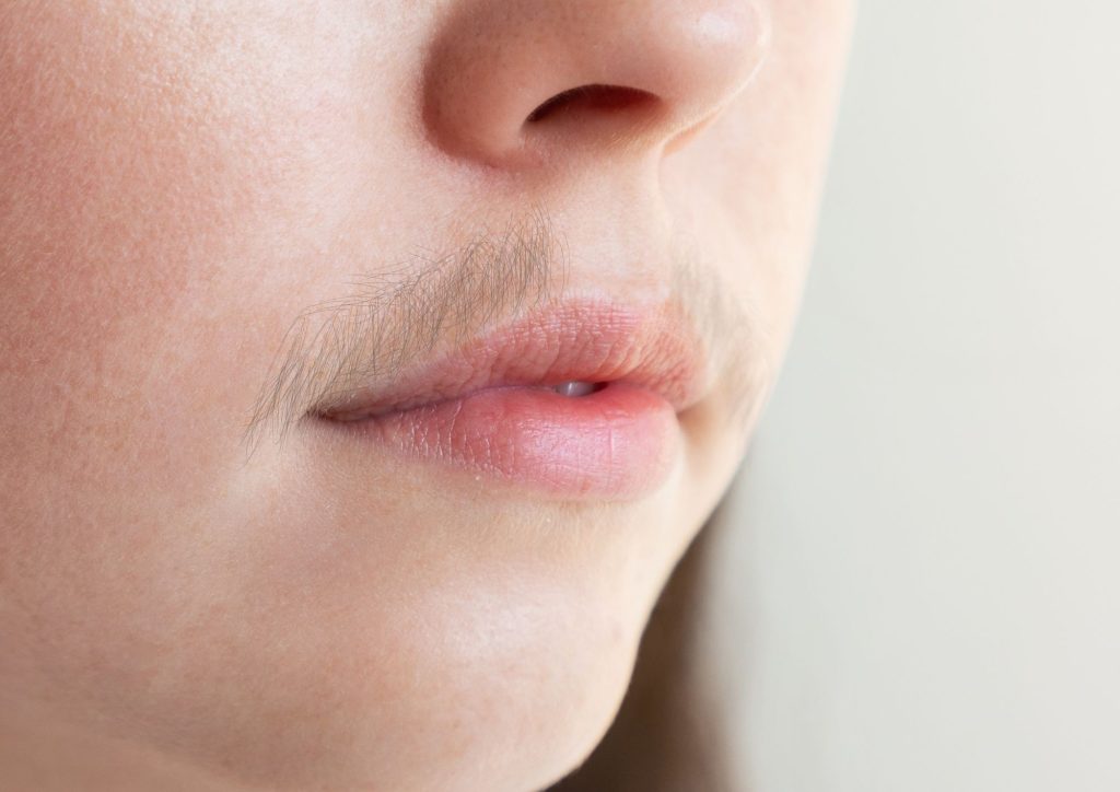 Hair Removal Treatment in Da Vinci Clinic KL