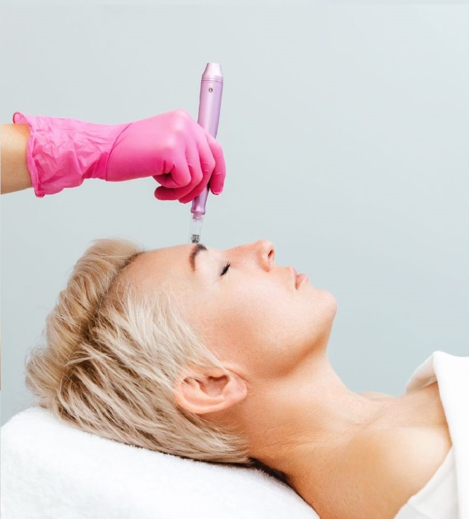 Microneedling treatment in Da Vinci Clinic