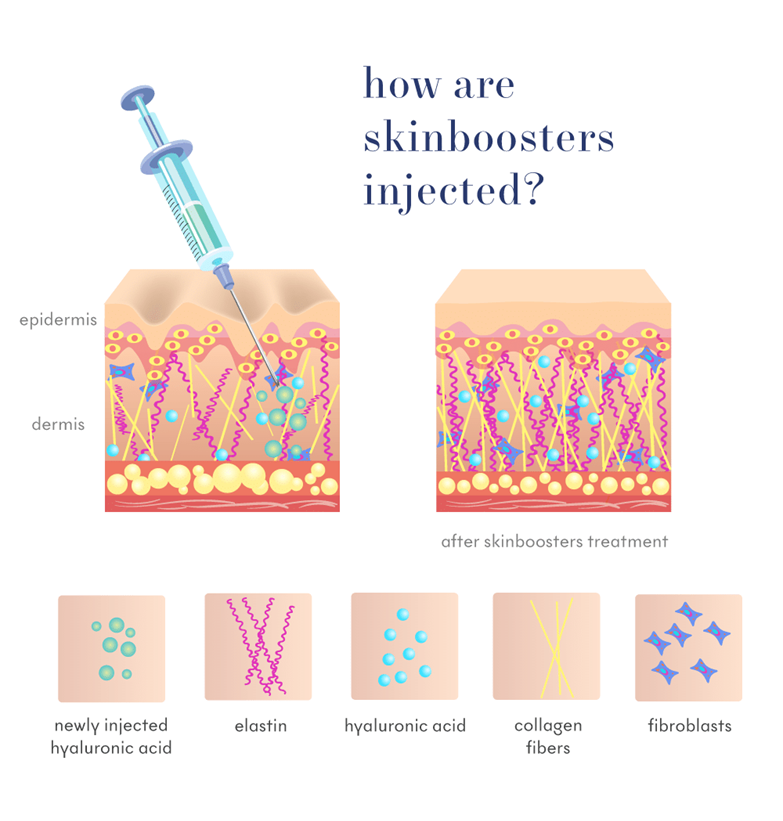 Skin Booster Injection