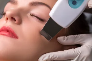 microneedling treatment