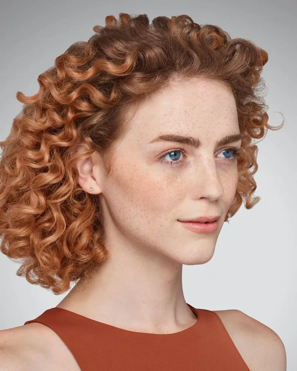 Addieson treatment before – Juvederm Dermal Fillers