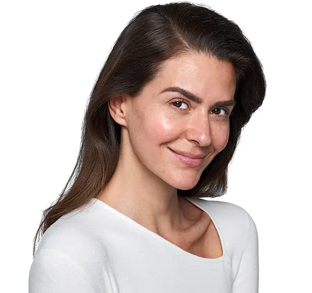 Janina After Treatment