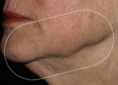 Richard Gentile MD After