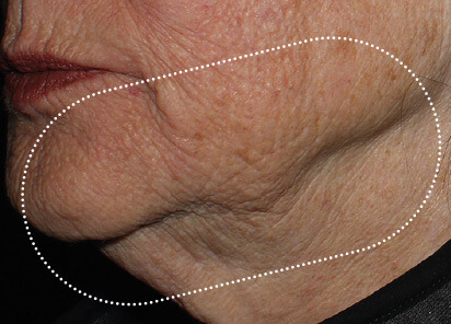 Richard Gentile MD Before