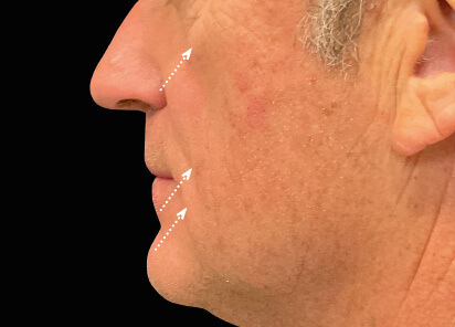 Charles Boyd MD After