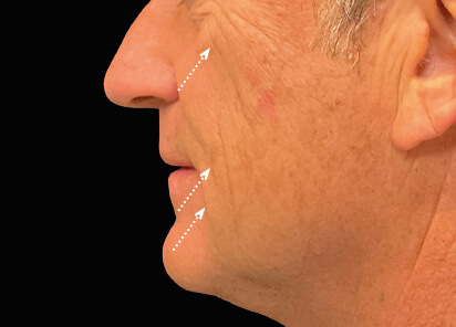Charles Boyd MD Before