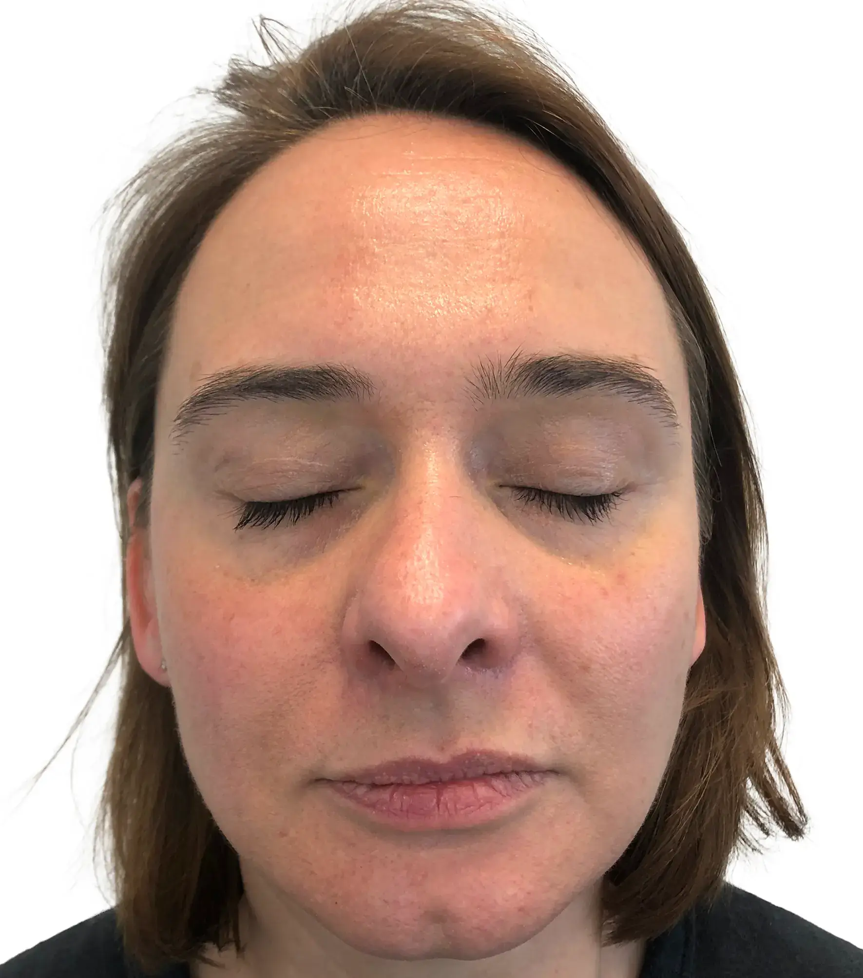 Kinga — After 3T (Front)