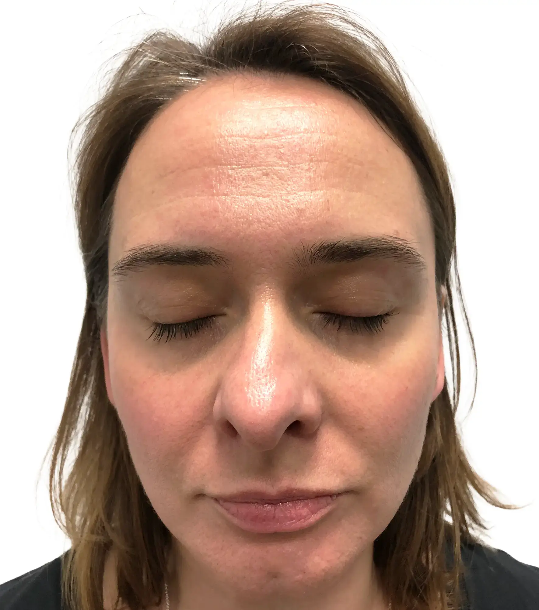 Kinga — Before (Front)