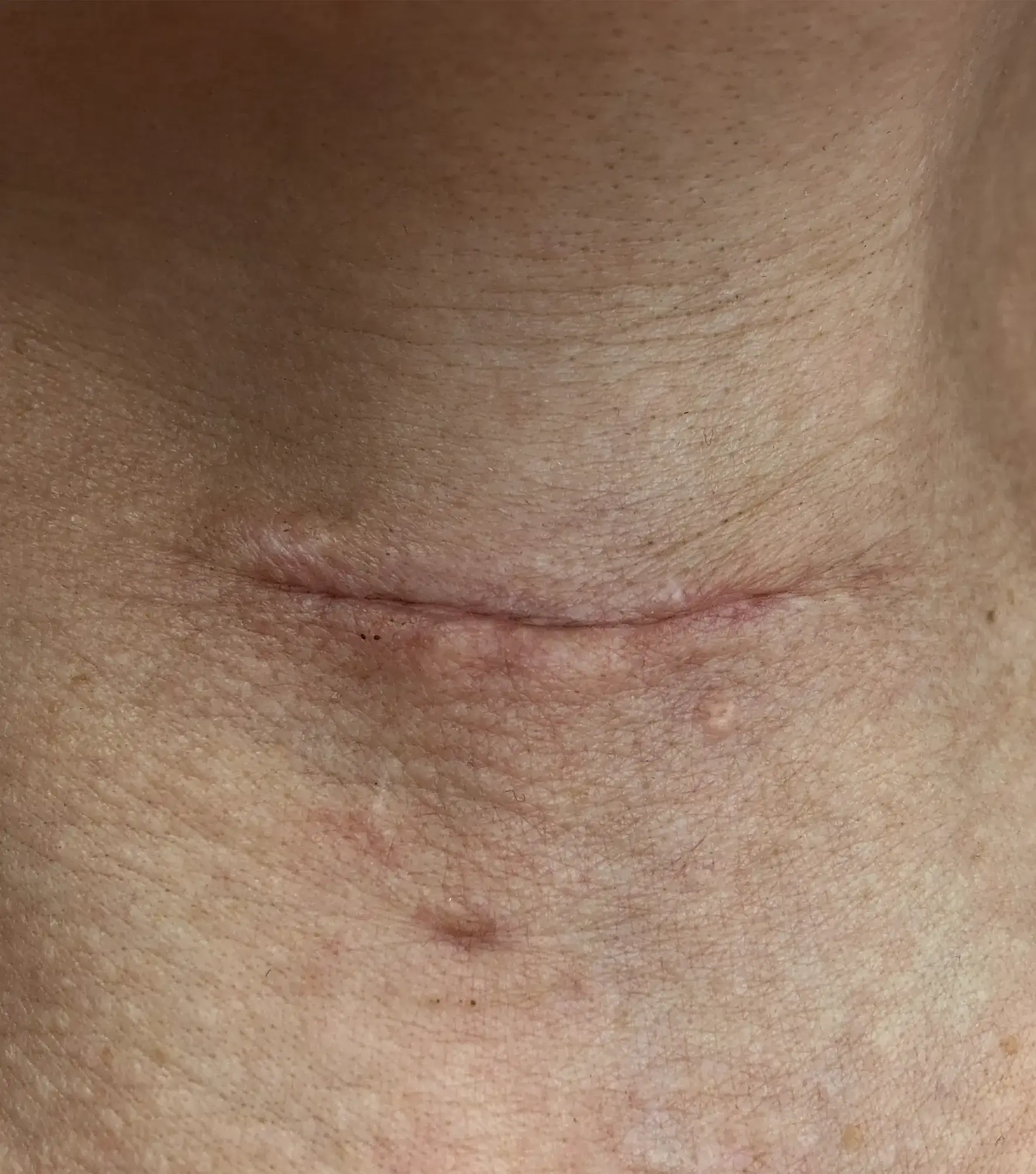 Dorota — Before (Front)