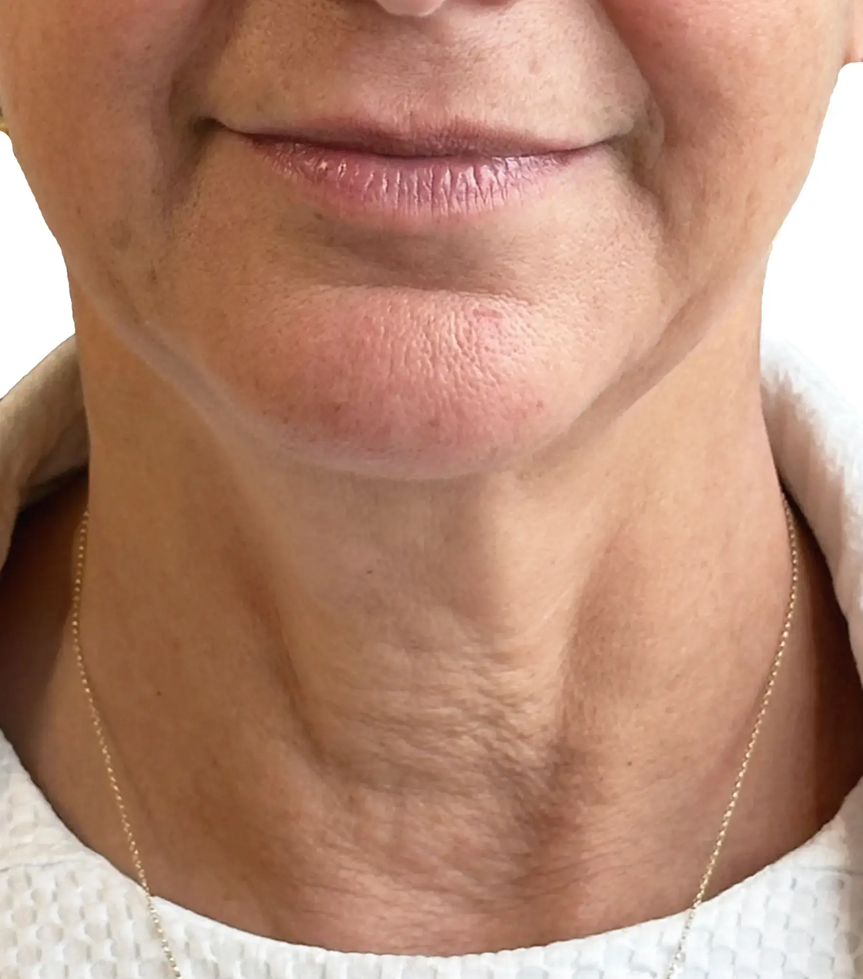 Saturnino — Before (Front)