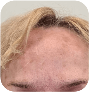 CELLBOOSTER GLOW Case 02 after