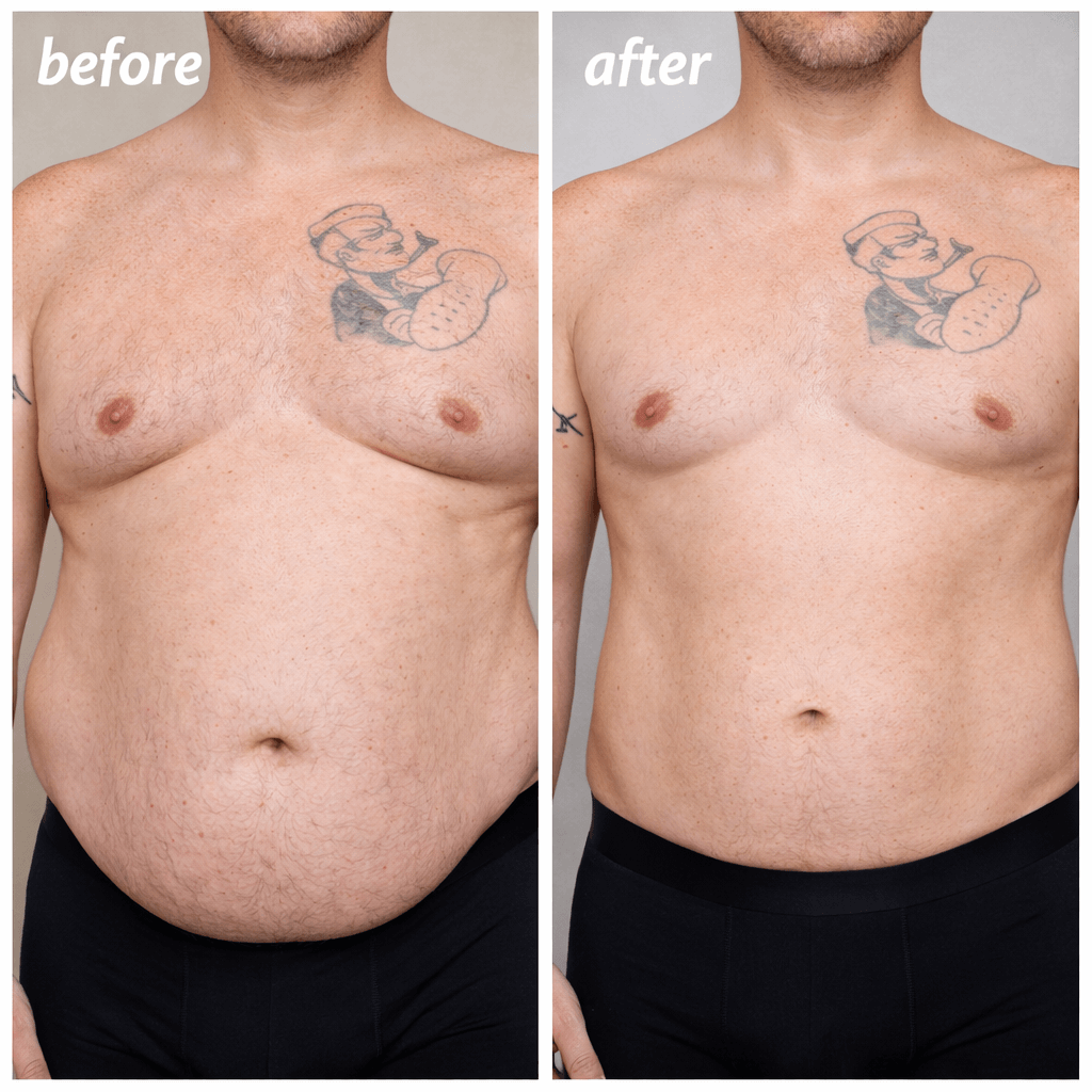 Wegovy Case C Visual