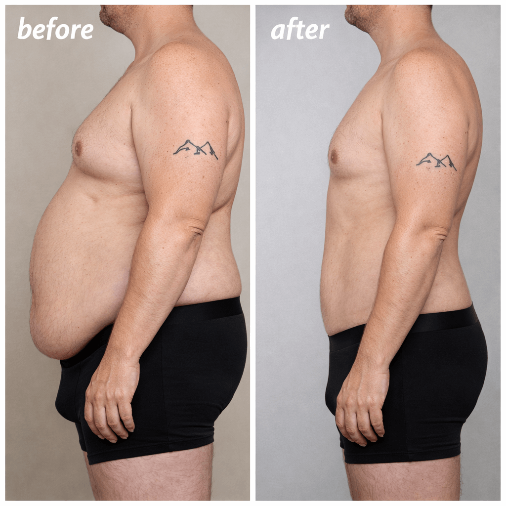 Wegovy Case B Visual