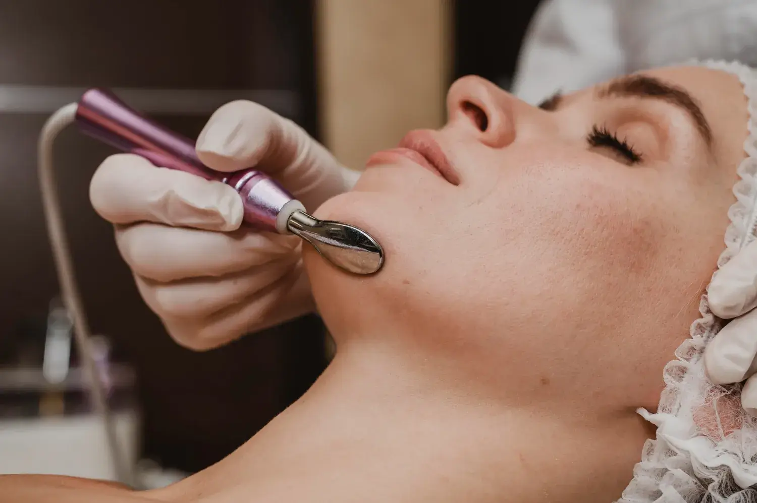 microneedling treatment