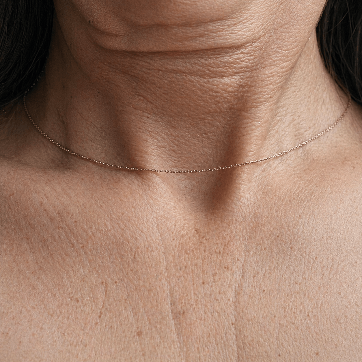 Neck and décolletage sagging with loose neck skin and crepey texture